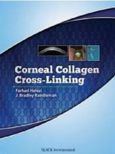 Corneal Collagen Cross Linking