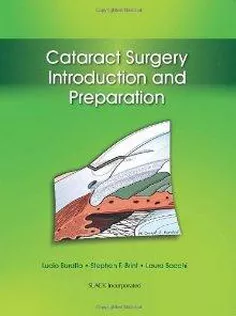 Cataract Surgery: Introduction And Preparation
