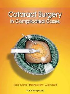Cataract Surgery In Complicated Cases