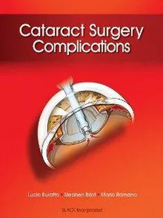 Cataract Surgery Complications