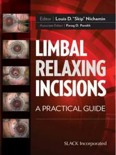 9781617118388 Limbal Relaxing Incisions: A Practical Guide