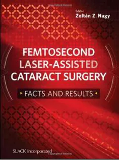 Femtosecond Laser-Assisted Cataract Surgery