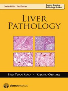 Liver Pathology