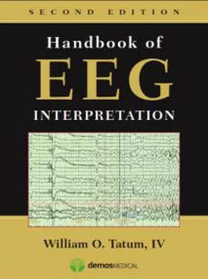 Handbook of EEG Interpretation 2014