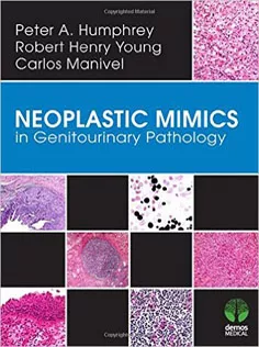 Neoplastic Mimics in Genitourinary Pathology
