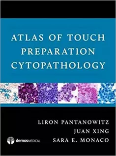 Atlas of Touch Preparation Cytopathology