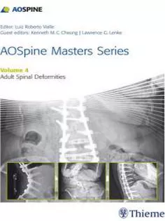 AOSpine Masters Series, Volume 4: Adult Spinal Deformities