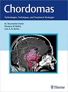 Chordomas: Technologies, Techniques, and Treatment Strategies