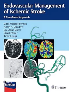 Endovascular Management of Ischemic Stroke: A Case-Based Approach