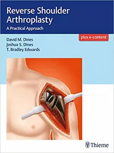 Reverse Shoulder Arthroplasty: A Practical Approach
