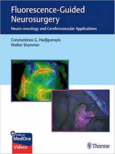 Fluorescence-Guided Neurosurgery