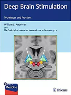 Deep Brain Stimulation: Techniques and Practices