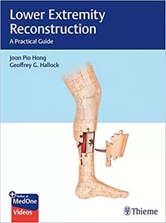 Lower Extremity Reconstruction: A Practical Guide