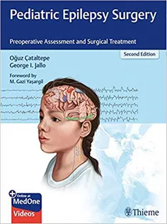 Pediatric Epilepsy Surgery: Preoperative Assessment and Surgical Treatment