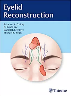 Eyelid Reconstruction