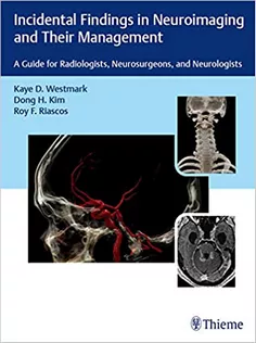 Incidental Findings in Neuroimaging and Their Management