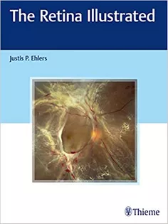 The Retina Illustrated