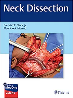 Neck Dissection