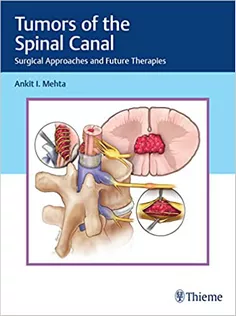 Tumors of the Spinal Canal: Surgical Approaches and Future Therapies