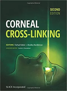 Corneal Cross-Linking