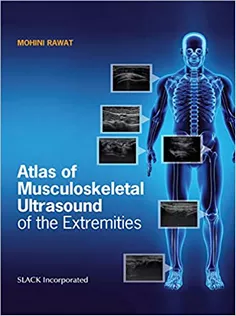 Atlas of Musculoskeletal Ultrasound of the Extremities