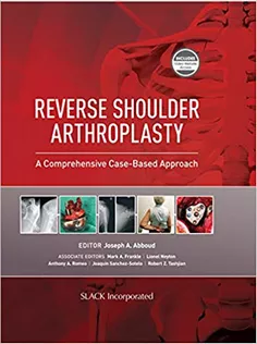 9781630916855 Reverse Shoulder Arthroplasty: A Comprehensive Case-Based Approach