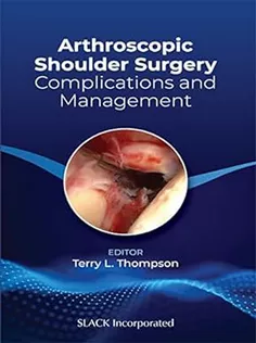 9781630917050 Arthroscopic Shoulder Surgery: Complications and Management
