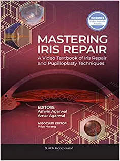 9781630917265 Mastering Iris Repair: A Video Textbook of Iris Repair and Pupilloplasty Techniques