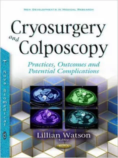 Cryosurgery and Colposcopy