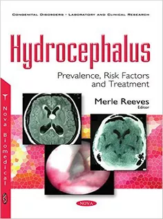 Hydrocephalus: Prevalence,Risk Factors and Treatment