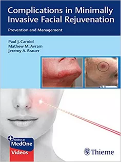 Complications in Minimally Invasive Facial Rejuvenation