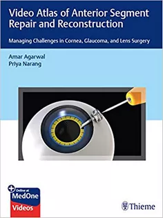 Video Atlas of Anterior Segment Repair and Reconstruction