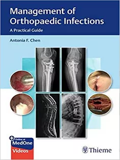 Management of Orthopaedic Infections: A Practical Guide