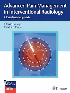 Advanced Pain Management in Interventional Radiology