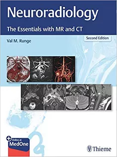Neuroradiology: The Essentials with MR and CT
