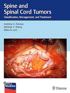 Spine and Spinal Cord Tumors Classification, Management, and Treatment