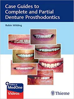 Case Guides to Complete and Partial Denture Prosthodontics