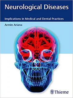 Neurological Diseases: Implications in Medical and Dental Practices