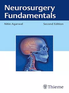 Neurosurgery Fundamentals
