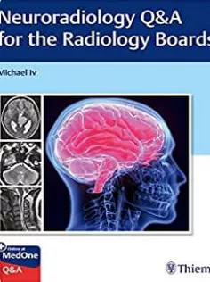 Neuroradiology Q&A for the Radiology Boards