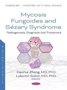 Mycosis Fungoides: Causes, Diagnosis and Treatment