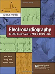 Electrocardiography in Emergency, Acute, and Critical Care