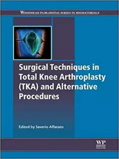 Surgical Techniques in Total Knee Arthroplasty and Alternative Procedures
