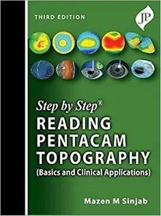 Step by Step Reading Pentacam Topography