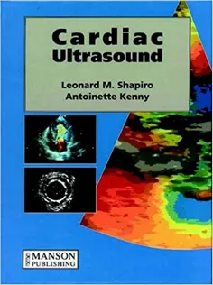 Cardiac Ultrasound