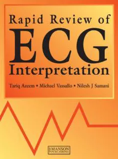 Rapid Review of ECG Interpretation