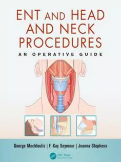 ENT and Head and Neck Procedures: An Operative Guide