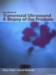 Handbook of Transrectal Ultrasound and Biopsy of the Prostate