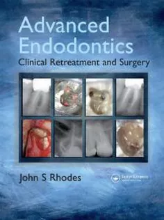 Advanced Endodontics