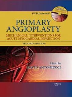 Primary Angioplasty: Mechanical Interventions for Acute Myocardial Infarction